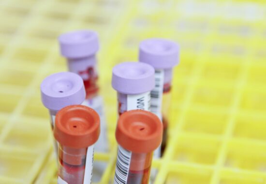Blood test vials
